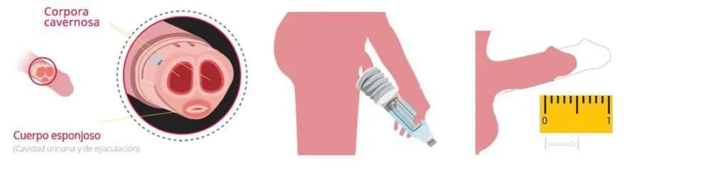 Home Bathmate como funciona Home Bathmate como funciona